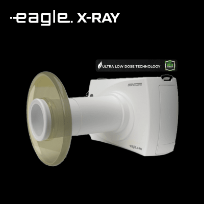 Eagle.X-RAY