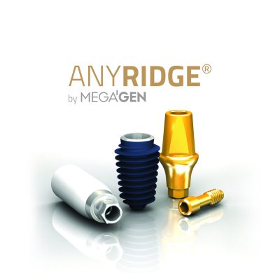 AnyRidge