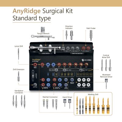 Kit Standard AnyRidge