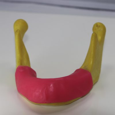 Modèle de pratique implantaire 2