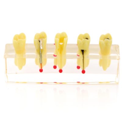 Modèle de traitements des maladies pulpaires