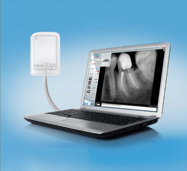 Capteur intra-oral NEW IDA