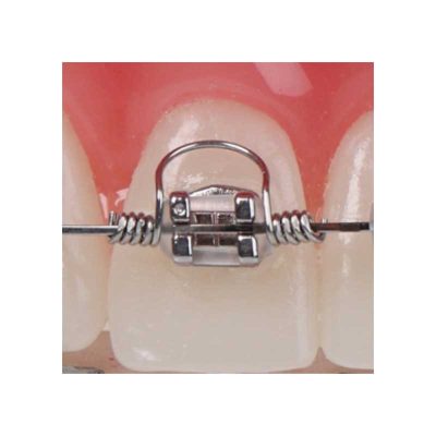 AMERICAN ORTHODONTICS / Warren Torquing Spring