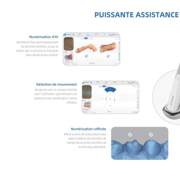 Aoralscan 3 Wireless – Image 7