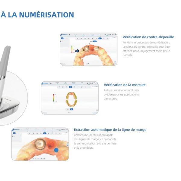 Aoralscan 3 Wireless – Image 8